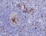 CD38 Antibody in Immunohistochemistry (Paraffin) (IHC (P))