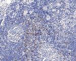 CTLA-4 Recombinant Rabbit Monoclonal Antibody (PS01-34)