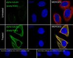Acetyl-alpha Tubulin (Lys40) Antibody in Immunocytochemistry (ICC/IF)