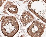 TUBA3C Antibody in Immunohistochemistry (Paraffin) (IHC (P))