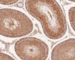 TUBA3C Antibody in Immunohistochemistry (Paraffin) (IHC (P))