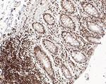 RBBP5 Antibody in Immunohistochemistry (Paraffin) (IHC (P))