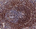 Phospho-S6 (Ser235, Ser236) Antibody in Immunohistochemistry (Paraffin) (IHC (P))