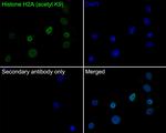 H2AK9ac Recombinant Rabbit Monoclonal Antibody (PS01-45)