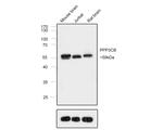 PPP3CB Antibody in Western Blot (WB)