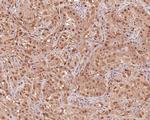 PSMC5 Recombinant Rabbit Monoclonal Antibody (PSH0-22)