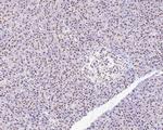 PBX1 Antibody in Immunohistochemistry (Paraffin) (IHC (P))