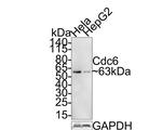 CDC6 Antibody in Western Blot (WB)