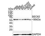 SEC62 Antibody in Western Blot (WB)