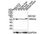 SEC62 Recombinant Rabbit Monoclonal Antibody (PSH0-25)