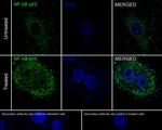NFkB p65 Recombinant Rabbit Monoclonal Antibody (PSH0-27)