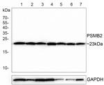 PSMB2 Recombinant Rabbit Monoclonal Antibody (PSH0-28)