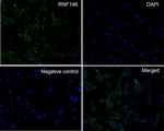 RNF146 Recombinant Rabbit Monoclonal Antibody (PSH0-29)