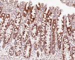 MAVS Antibody in Immunohistochemistry (Paraffin) (IHC (P))