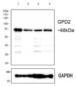 GPD2 Recombinant Rabbit Monoclonal Antibody (PSH0-31)
