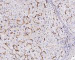 CD14 Antibody in Immunohistochemistry (Paraffin) (IHC (P))