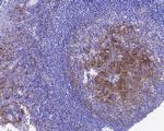 CD14 Antibody in Immunohistochemistry (Paraffin) (IHC (P))