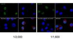 Cyclin D1 Recombinant Rabbit Monoclonal Antibody (PD01-64)