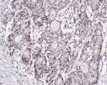 MLH1 Recombinant Rabbit Monoclonal Antibody (PD01-61)
