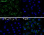 CRALBP Recombinant Rabbit Monoclonal Antibody (JE35-09)