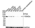 RTN3 Antibody in Western Blot (WB)