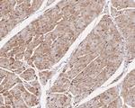 Arp2 Antibody in Immunohistochemistry (Paraffin) (IHC (P))