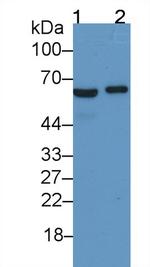Ferroportin Monoclonal Antibody (C9)