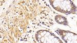 beta Tubulin Antibody in Immunohistochemistry (Paraffin) (IHC (P))