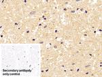 beta Tubulin Antibody in Immunohistochemistry (Paraffin) (IHC (P))