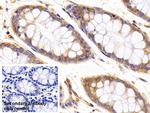 beta Tubulin Antibody in Immunohistochemistry (Paraffin) (IHC (P))