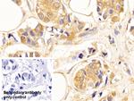 beta Tubulin Antibody in Immunohistochemistry (Paraffin) (IHC (P))