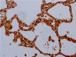 beta Tubulin Antibody in Immunohistochemistry (Paraffin) (IHC (P))