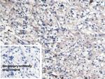 S100A8 Monoclonal Antibody (C6)