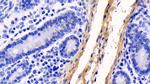 COL1A1 Antibody in Immunohistochemistry (Paraffin) (IHC (P))