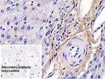 COL1A1 Antibody in Immunohistochemistry (Paraffin) (IHC (P))