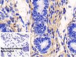 COL1A1 Antibody in Immunohistochemistry (Paraffin) (IHC (P))