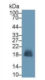 RNASE2 Antibody in Western Blot (WB)