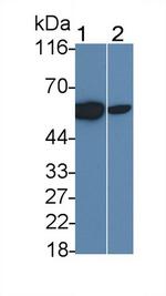 CD122 Monoclonal Antibody (D4)
