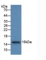 Cystatin B Monoclonal Antibody (C6)