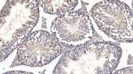 Cyclophilin A Antibody in Immunohistochemistry (Paraffin) (IHC (P))