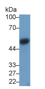 VEGFC Monoclonal Antibody (D3)