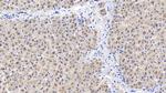 CEACAM1 Monoclonal Antibody (C4)