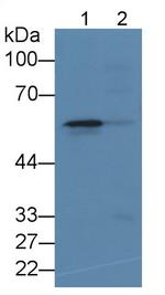 ALOX5 Monoclonal Antibody (D2)