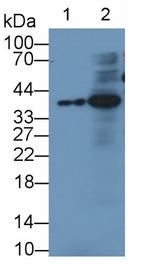 IGFBP3 Monoclonal Antibody (D1)