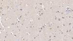 FGF13 Monoclonal Antibody (C1)