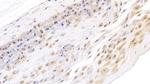 Ceruloplasmin Monoclonal Antibody (D3)