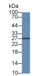 BDNF Monoclonal Antibody (C3)