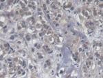 KIR2DS4 Antibody in Immunohistochemistry (Paraffin) (IHC (P))