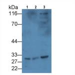 KIR2DS4 Antibody in Western Blot (WB)