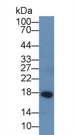 Chemerin Monoclonal Antibody (D2)